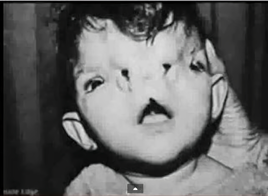 放射能と奇形児　旧ソ…