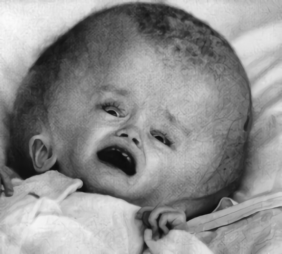 放射能と奇形児　旧ソ…