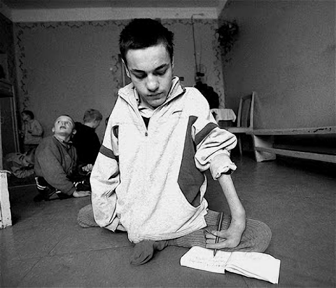 放射能と奇形児　旧ソ…