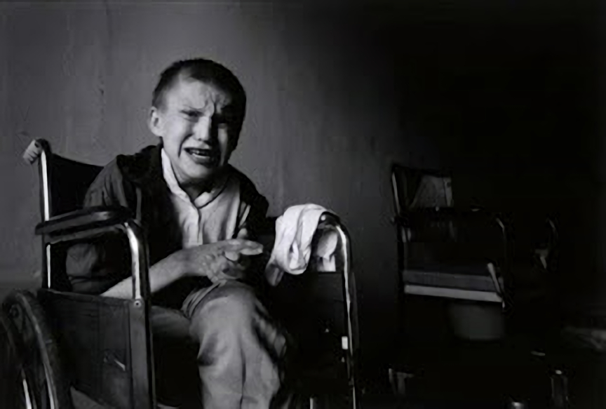 放射能と奇形児　旧ソ…