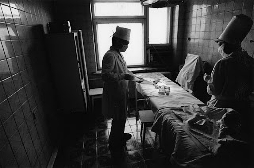 放射能と奇形児　旧ソ…