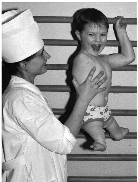 放射能と奇形児　旧ソ…