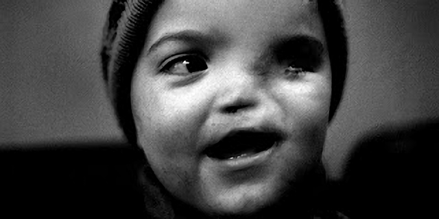 放射能と奇形児　旧ソ…