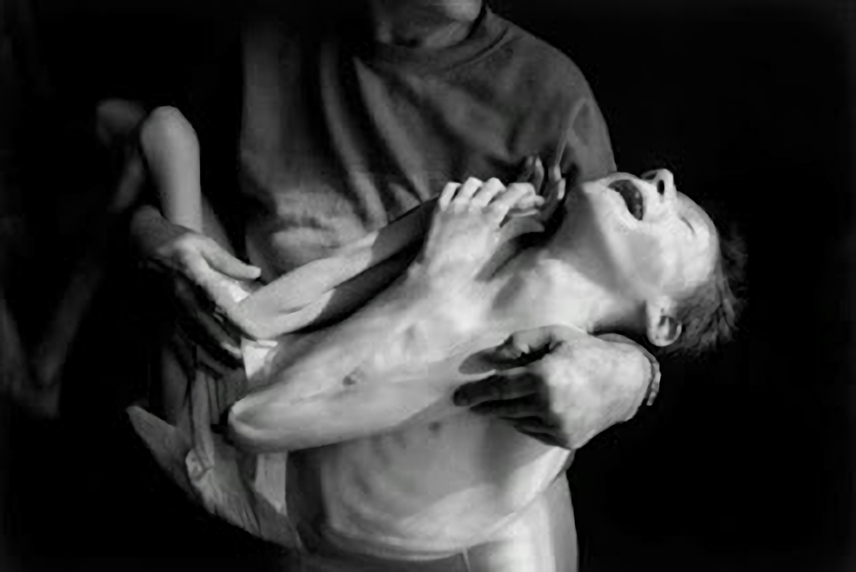 放射能と奇形児　旧ソ…