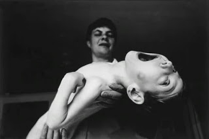 放射能と奇形児　旧ソ…