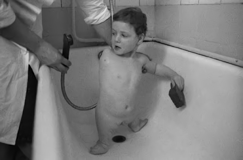 放射能と奇形児　旧ソ…