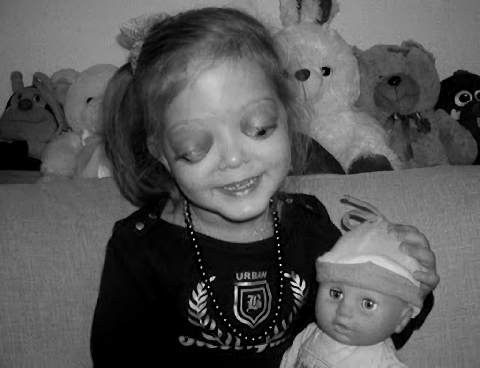 放射能と奇形児　旧ソ…