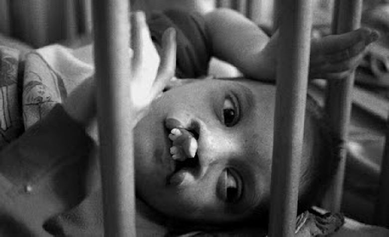 放射能と奇形児　旧ソ…