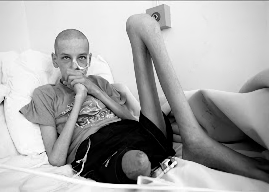 放射能と奇形児　旧ソ…