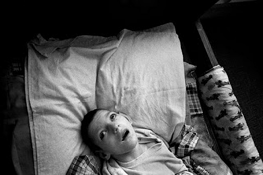 放射能と奇形児　旧ソ…