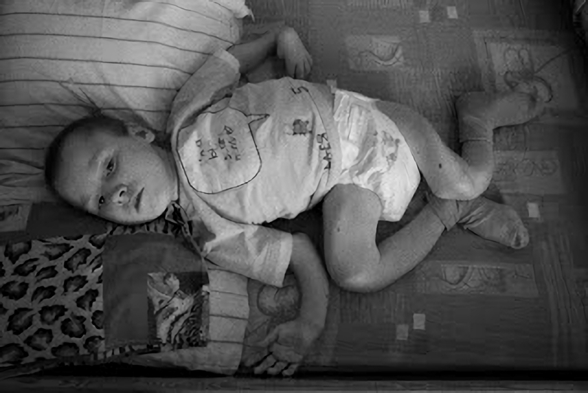 放射能と奇形児　旧ソ…